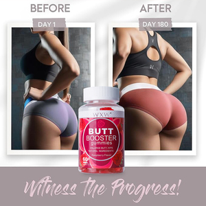 WXW 스톡 엉덩이 확대 구미 자연 더 큰 엉덩이와 엉덩이 Bbl 구미 건강 보충제 구미 - Product Image 3