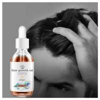 Huile de croissance des cheveux pour hommes Canton Fair Huile de croissance des cheveux OEM ODM Vente en gros de produits de croissance des cheveux Sérum de croissance des cheveux