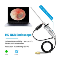 Endoscope médical USB haute définition 1080P portable à lumière froide avec grossissement 6x et fonction de congélation