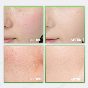 Vegan Anti-Envelhecimento Rosto Soro Vara Chá Verde Colágeno Niacinamida Hidratante Hidratante Bálsamo Vara para Lábios Witch Hazel Peptídeos - Product Image 2