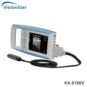 Alat USG Sapi Sektor Mekanik Digital Penuh KX-5100 Murah - Product Image 2