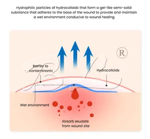 Akne yama hidrokolloid su geçirmez şeffaf görünür sivilce yama cilt bakımı için