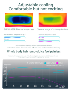 <span class=keywords><strong>2025</strong></span> Mới Xách Tay <span class=keywords><strong>Diode</strong></span> <span class=keywords><strong>Laser</strong></span> 755 808 1064nm 3 Sóng Tóc Loại Bỏ Máy Với 1200W 1800W 2000W Công Suất Cao Cho Salon Phòng Khám Sử Dụng - Product Image 6