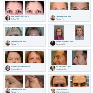 <span class=keywords><strong>Polvere</strong></span> Viso Antietà e Antirughe Professionale per la Cura della Pelle - Bestseller - Product Image 5