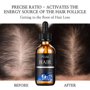 Suero Revitalizante para el Cuero Cabelludo con Desoxirribosa de Marca Privada, Suero para el Crecimiento del Cabello con Desoxirribosa para el Cuidado Capilar - Product Image 4