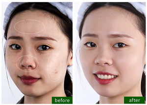 OEM BIOAQUA Private Label piccolo maiale nero maschera di fango pulizia profonda idratante acido carbonico bolla maschera facciale all'ingrosso - Product Image 6