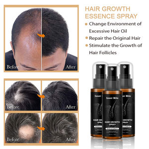 Saç çıkma yağı anti saç dökülmesi OEM/ODM saç tedavisi özel etiket büyüme spreyi - Product Image 5