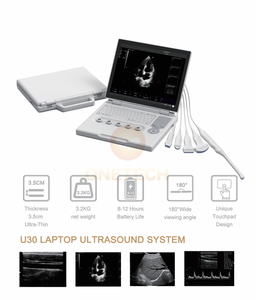 Diagnosis umum mesin <span class=keywords><strong>Ultrasound</strong></span> portabel, pemindai <span class=keywords><strong>Ultrasound</strong></span> Laptop <span class=keywords><strong>15</strong></span> inci DICOM dan PW fungsional B51 - Product Image 4