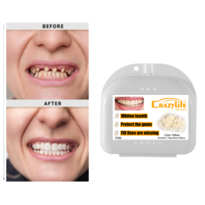 50 pièces/sac, facettes dentaires antérieures supérieures, <span class=keywords><strong>couronne</strong></span> temporaire pour soins dentaires, dentiste, fausses dents, blanchiment des dents, kits de réparation - Product Image 2
