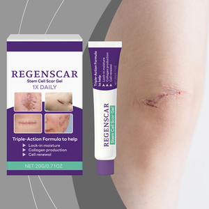 Crema para Eliminar Cicatrices, Hiperplasia, Quemaduras, Lesiones por Escaldaduras, Cicatrices Quirúrgicas, Estrías, Eliminador de Cicatrices y Marcas - Product Image 5