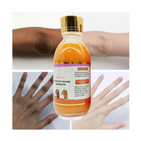 Sérum Éclaircissant Anti-Taches Foncées pour Jointures, Huile Illuminatrice pour Mains et Corps, Sérum Éclaircissant Facial pour Peau Noire