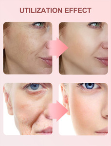 Suero Facial 4 en 1 para el Cuidado <span class=keywords><strong>de</strong></span> la Piel, Hidratante, Reparador y Reafirmante, 30 ml/botella, Personalizado OEM - Product Image 1