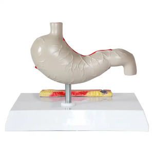 Equipo de enseñanza médica, ciencia médica, modelo de órgano humano patológico gástrico, modelo de anatomía, modelo de estómago - Product Image 3