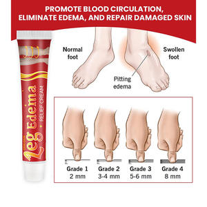 Crema para el Cuidado Corporal para el Alivio del Edema de Manos y Pies, Precio al por Mayor - Product Image 4