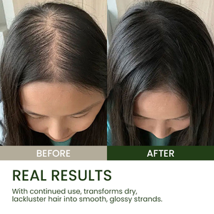 Natürliches Haarausfall-Behandlungs serum mit <span class=keywords><strong>Biotin</strong></span>-Ingwer-Teebaumex trakt Bio-Vegan-Formel für beschädigte Haar reparatur - Product Image 5