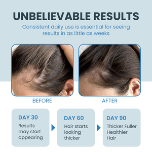 GHK-Cu Traitement de croissance des cheveux Extrait de <span class=keywords><strong>biotine</strong></span> <span class=keywords><strong>Masque</strong></span> peptidique en cuivre bleu Crème nourrissante anti-chute de cheveux Soin hydratant en profondeur - Product Image 5