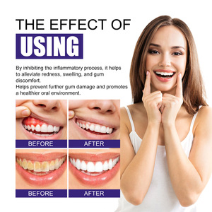 Spray chinois <span class=keywords><strong>Zou</strong></span> Run an 30ml à base de plantes pour les maux de dents |   Spray buccal naturel à la consoude pour soulager instantanément la douleur dentaire et favoriser la santé des gencives - Product Image 2