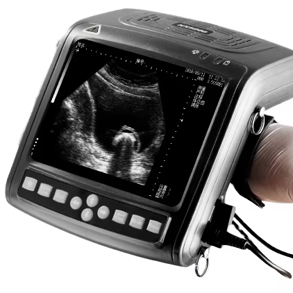 Hot Sale Portable Wireless Doppler Ultrasound