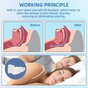 Protector Bucal Anti-Ronquidos Ajustable, Dispositivo Anti-Ronquidos Profesional, Protector Bucal Anti-Ronquidos Reutilizable - Product Image 2