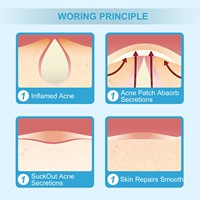 Patch hydrocolloïde invisible personnalisable pour boutons, soutien de l'acné, patchs nasaux et corporels