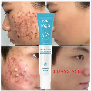 Gel Traitant l'Acné à l'Acide Salicylique Transfrontalier – Réduit les Marques d'Acné, Élimine les Boutons, Resserre les Pores, Essence Végétale - Product Image 1