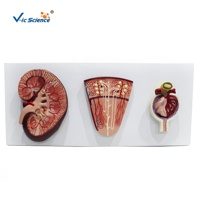Modelo Anatómico de Glómerulo Renal con Ampliación, PVC, Ciencia Médica