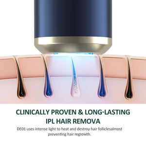 Appareil professionnel d'épilation Laser IPL marque privée usage domestique beauté lumière pulsée intense Portable pour application domestique - Product Image 3