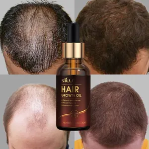 Hızlı organik argan yağı erkek kadın kafa derisi kök saç büyüme serumu amla chebe bitkisel saç büyüme yağı