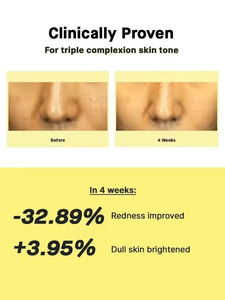 Etrun Alisa เซรั่มบำรุงผิวหน้า Niacianmide แบรนด์ส่วนตัวทำให้ผิวเรียบเนียนกระจ่างใสไร้ริ้วรอยเล็กๆเซรั่มจุดด่างดำ - Product Image 4