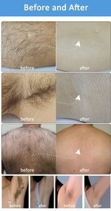 Appareil portable d'épilation au laser à diode semi-conductrice 808 nm et de soin de la peau avec écran tactile pour usage commercial et domestique - Product Image 6