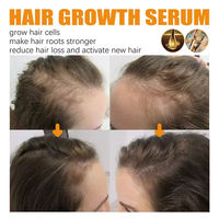 Semprotan Rambut Herbal Biotin untuk Pria Wanita 30ml Perawatan Pertumbuhan Rambut, Perbaikan, Penghalus Minyak, Perawatan Kulit Kepala, Menebalkan Rambut