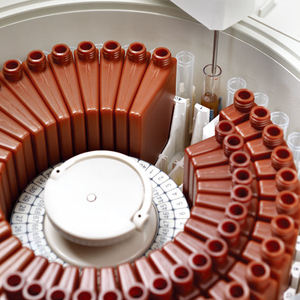 Analizador de Química automático para veterinarios Mindray, máquina de prueba de Bioquímica veterinaria, rendimiento fiable de alto rendimiento - Product Image 5