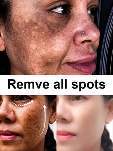 OEM ODM ชุดดูแลผิว <span class=keywords><strong>gluta</strong></span> Vitamin C Kojic Acid โลชั่นฟอกสีขาวช่วยทำให้กระชุดดูแลผิวกระจ่างใส - Product Image 5