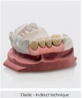 Silicone dentaire rose 50 ml haute brillance pour la fabrication de masques gingivaux et de prothèses implantaire