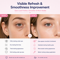 Masques rafraîchissants pour les yeux à la caféine, aux peptides, au collagène et à l'ADN de saumon, patchs hydrogel PDRN pour les yeux gonflés et les cernes