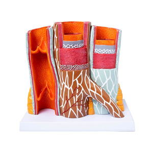 Medical Science Anatomical Coronary Artery Cardiovascular Artery Model Human Pathological Thrombus Models - Product Image 1