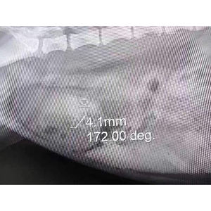 SY-WPS01 Veterinary Holmium <strong>Laser</strong> Lithotripter <strong>Surgical</strong> Use Minimally Invasive Lithotripsy Stone Fragmentation Machines - Product Image 5