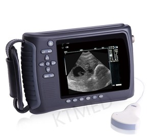 Équipement d'échographie vétérinaire médicale portable et économique KT-W002, scanner de diagnostic par ultrasons pour animaux - Product Image 6