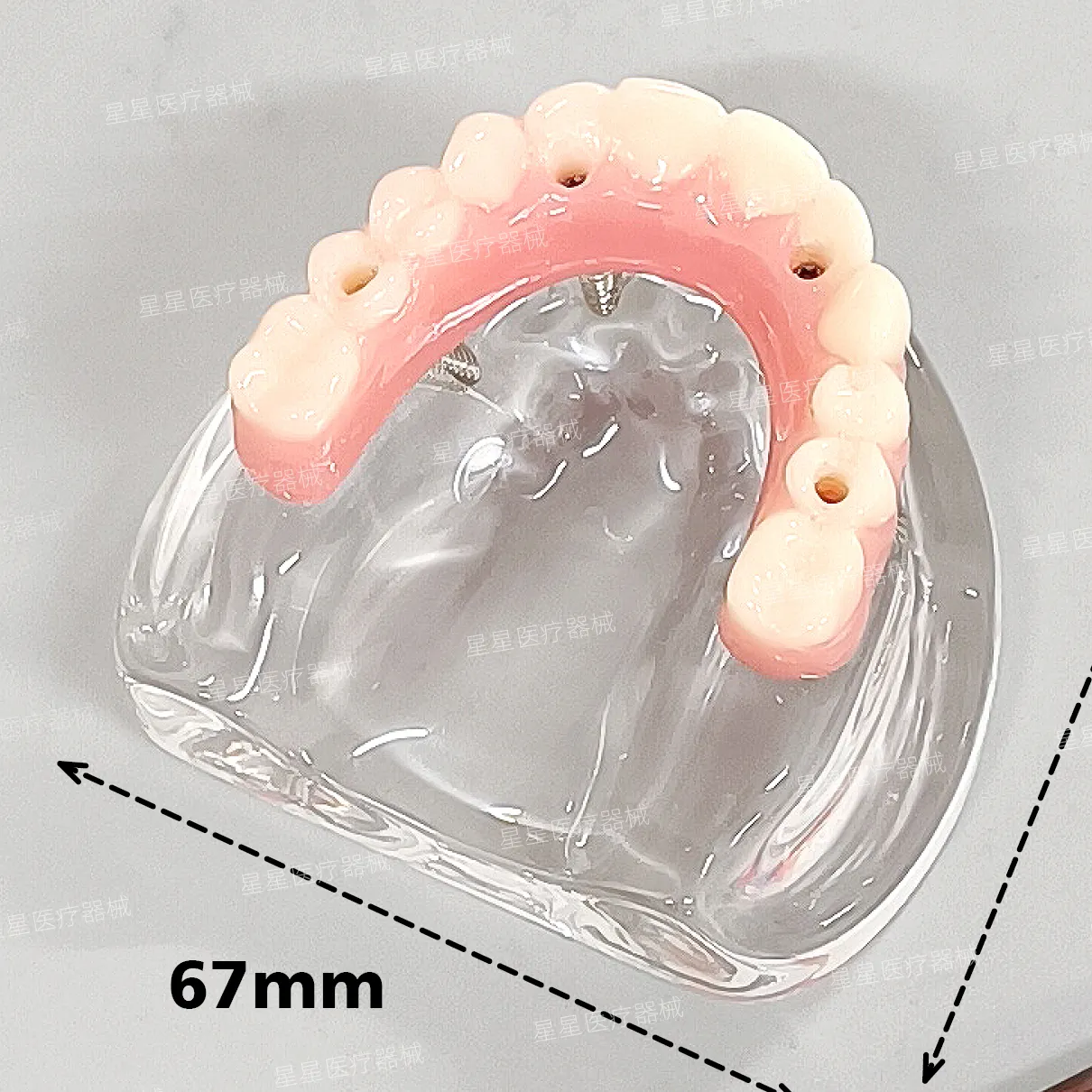 All on 4 speedy model ALL-ON -4 implant model