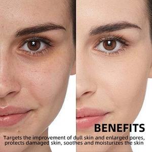 Nicotinamide 10 + TXA 4 özü hyaluronik asit cilt yüz özü Oral sıvı Vitamin B12 arındırıcı parlatıcı Revealing asit - Product Image 4