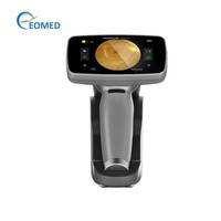 Caméra de fond d'œil portable non mydriatique EO-Med HYDC07-VET, instrument ophtalmique, champ de vision 60°, résolution 16MP, mise au point automatique/motrice