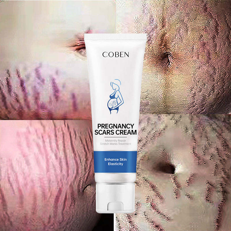 100% Natural Vegan Anti Postpartum Acne Scar Maternity Skin Care Removal Stretch Mark Cream for Tummy, Boobs, Hips and Thighs