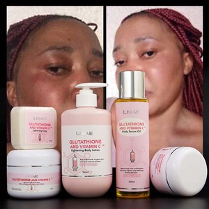 Conjunto de cuidado de la piel para mujer Kojic Niacinamida Crema blanqueadora AHA Vitamina C Ganoderma-Rejuvenecedor brillante - Product Image 1