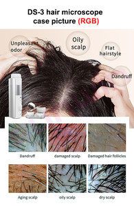Intelligent Hair Scalp Analyzer 16MP 10X-200X Magnification Follicle Detection Machine for Hair Loss & Dandruff Scalp Diagnosis - Product Image 4