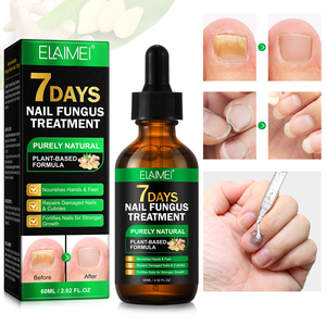 ELAIMEI Private Label 60ml naturale 7 giorni trattamento fungino dello zenzero unghie riparazione olio siero originale per la crescita rapida delle unghie siero - Product Image 6
