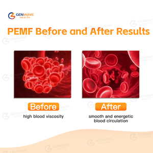 Appareil de thérapie magnétique PEMF pour chevaux, traitement équin, vente chaude, boucle PMST, thérapie par champ électromagnétique pulsé physique portable - Product Image 6