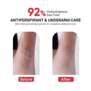 โรลออนระงับกลิ่นกายใต้วงแขนสูตร OEM แบบกำหนดเอง ผสม Nonapeptide AHA BHA ช่วยปรับผิวให้กระจ่างใส ควบคุมกลิ่นกาย ลดเลือนจุดด่างดำ บำรุงผิวกาย - Product Image 6