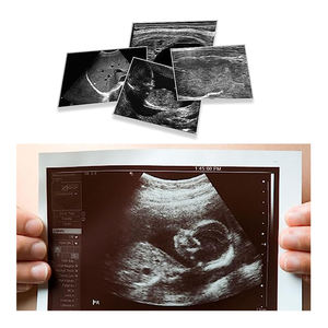 Petit pain de papier thermique d'ultrason de haut <span class=keywords><strong>Dentisy</strong></span> B pour le type I de UPP-110S de 110*20mm Sony - Product Image 1