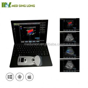 <span class=keywords><strong>Probe</strong></span> <span class=keywords><strong>Ultrasound</strong></span> Nirkabel Super MSK 10Mhz <span class=keywords><strong>128</strong></span> elemen / Pemindai <span class=keywords><strong>Ultrasound</strong></span> Doppler Warna CU88 - Product Image 5