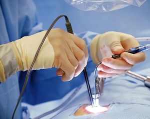 Tazlaser más nuevo médico proctología diodo láser 980nm + 1470nm dispositivo de tratamiento eliminación hemorroides pilas/fístula/seno <span class=keywords><strong>pilonidal</strong></span> - Product Image 6